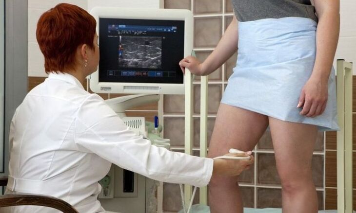 Lasecoagulación para o tratamento das varices