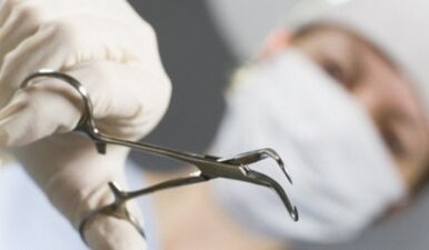 Intervención cirúrxica para varices