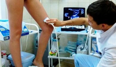 Preparación para a operación en varices