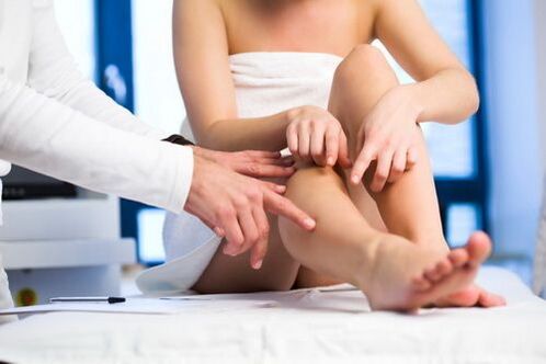 Tipos de varices